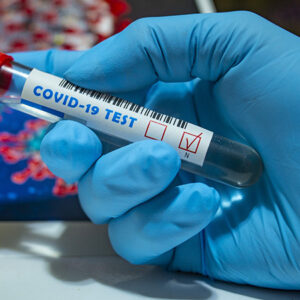 COVID-19 PCR Test in Kampala