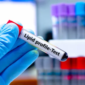 LIPID PROFILE (Blood Cholestrol test)