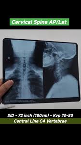 Cervical Xray AP-LAT