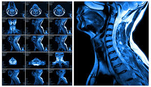 NECK MRI NON CONTRAST